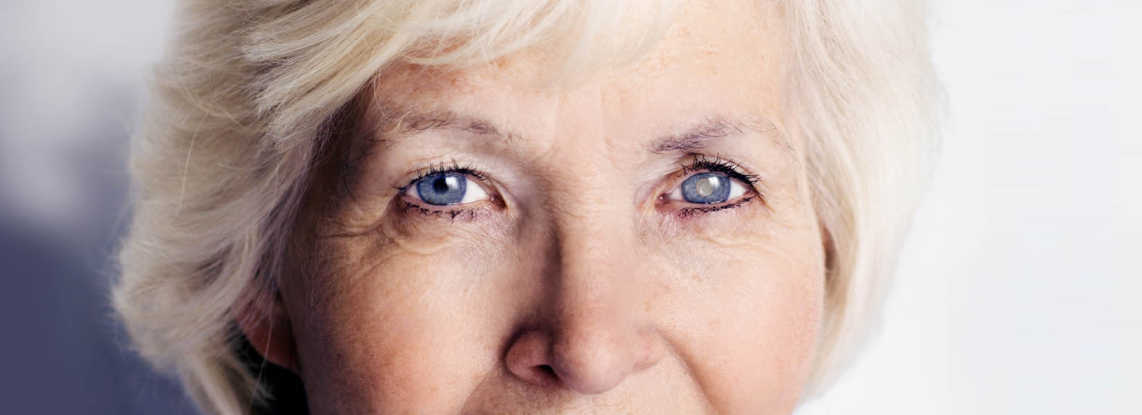 Cataract Surgery in La Porte